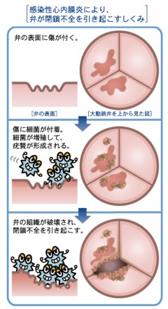 IEができるまで